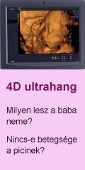 4d ultrahang
